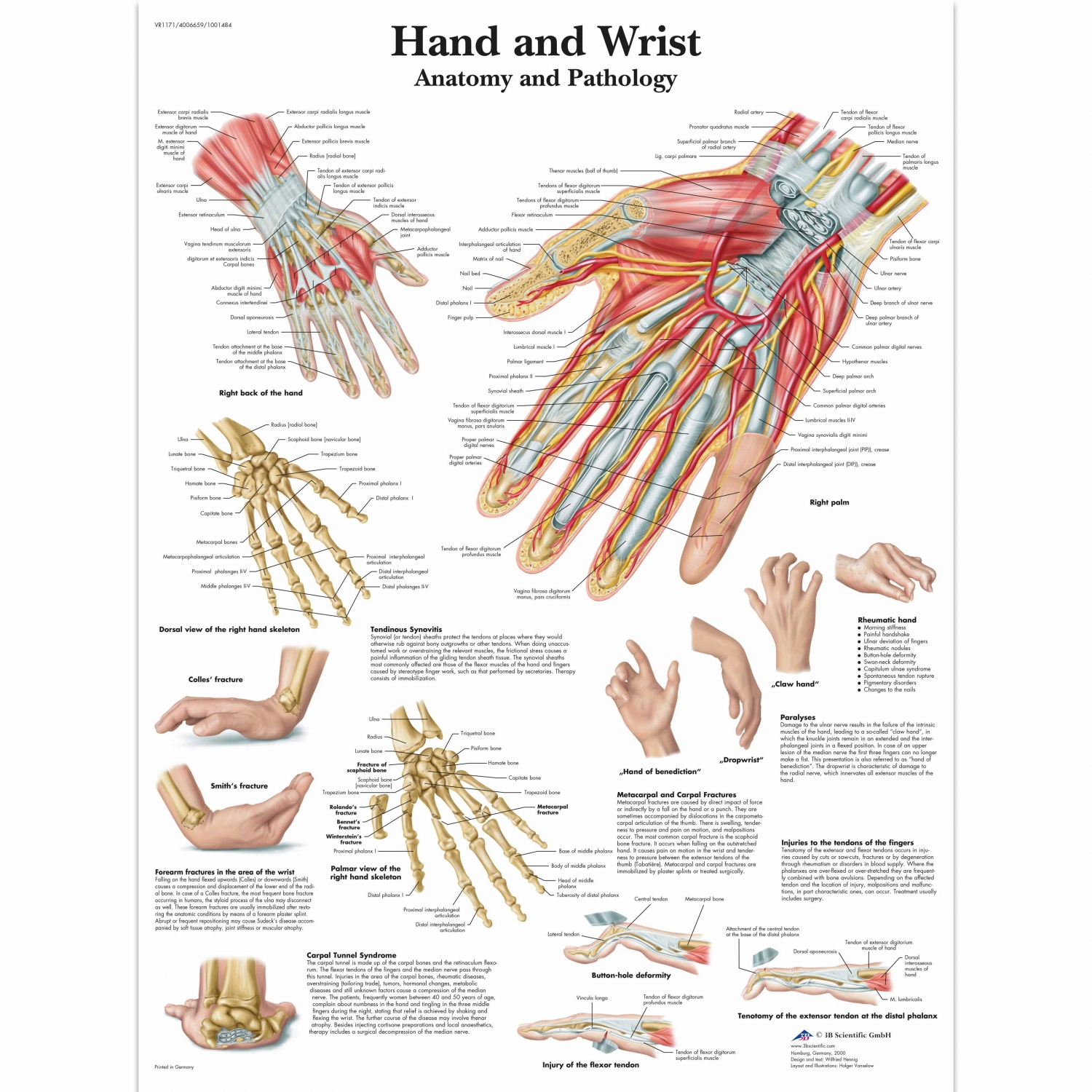 Wandplaat geplastificeerd Hand and Wrist - 50 x 67 cm